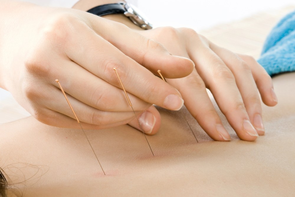 Acupuncture Treatment: How Does It Work?