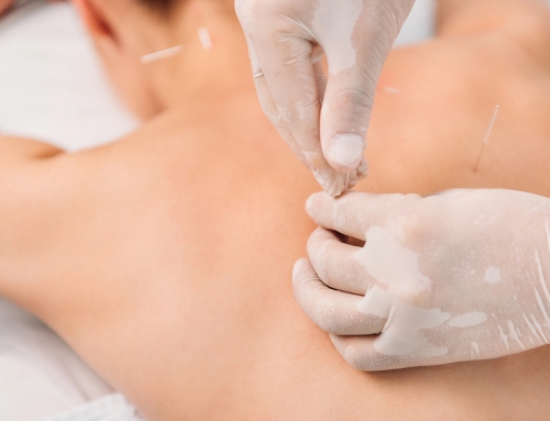 Understanding The Benefits Of Acupuncture Treatment