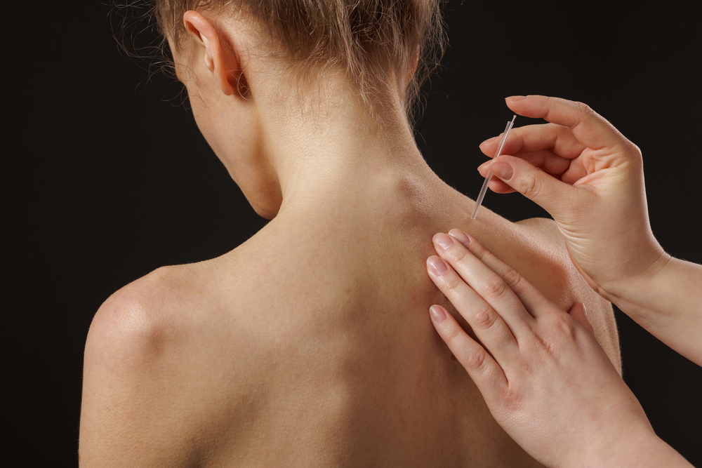 What Are The Benefits Of Acupuncture For Women?
