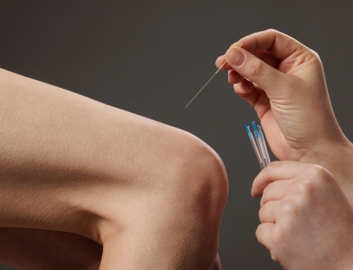 Why You Should Consider Acupuncture For Knee Pain